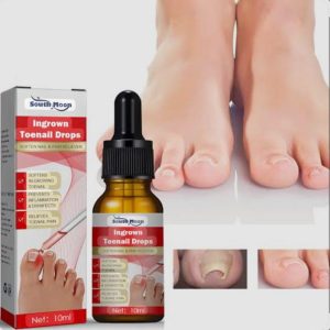 30 ML South Moon Ingrown Toenail Drops